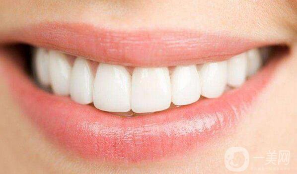 上海做貴金屬烤瓷牙多少錢