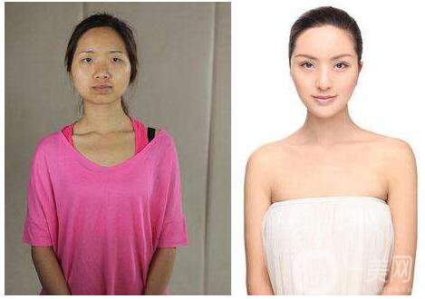 彩光嫩膚有用嗎 術(shù)后護理簡析