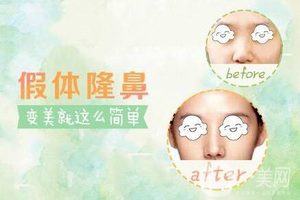 硅膠隆鼻可以維持一生嗎？