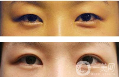 *整形手術術前準備要做些什么