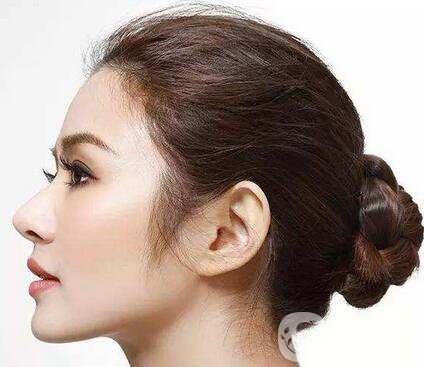 隆鼻能保持一輩子嗎？