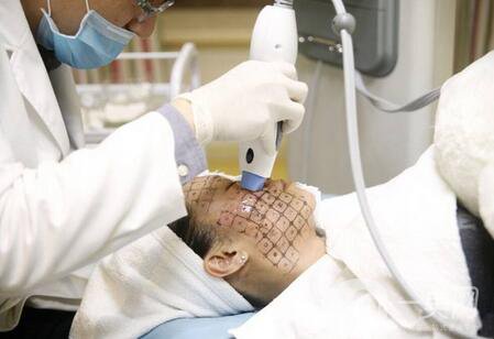 熱瑪吉緊膚除皺價格多少錢？