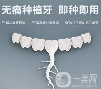 上海,人工種植牙,價(jià)格