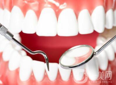 上海鈷鉻烤瓷牙價(jià)格一般是多少錢