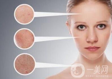 像素激光祛斑價(jià)格多少錢？