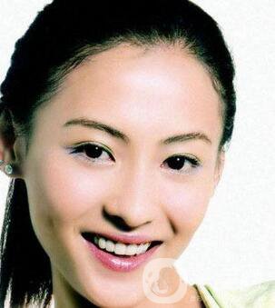 上海鈷鉻烤瓷牙價(jià)格一般是多少錢