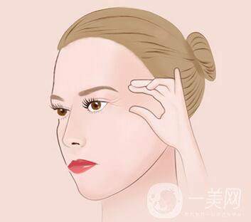 等離子除皺怎么樣 有些什么危害