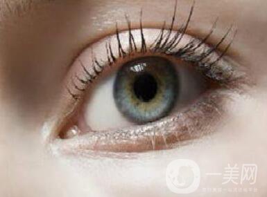 割雙眼皮,割雙眼皮注意事項