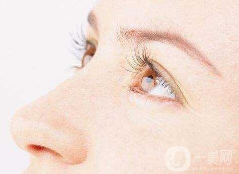 埋線雙眼皮5天能消腫嗎？