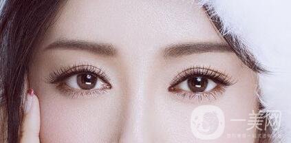 全切雙眼皮多久恢復(fù)？