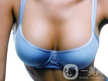 硅膠隆胸能管多久？隆胸手術(shù)具體費用