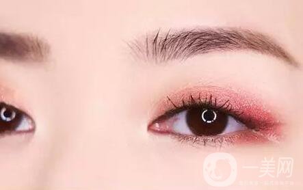 雙眼皮全切拆線后護(hù)理怎么做