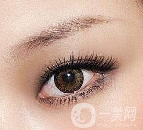 雙眼皮全切拆線后護(hù)理怎么做