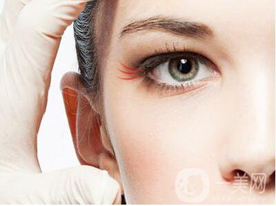 深圳去除魚尾紋,去除魚尾紋,去除魚尾紋多少錢