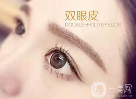 割雙眼皮痕跡多久消失？