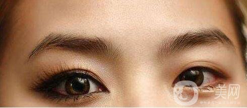 開眼角,開眼角手術(shù)過程,上海開眼角手術(shù)過程