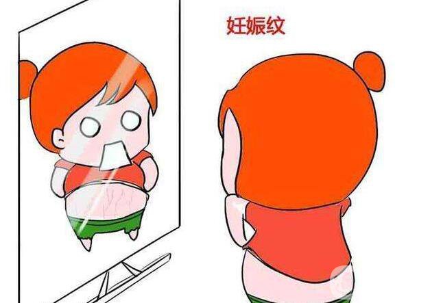 激光去妊娠紋,激光去妊娠紋費(fèi)用,深圳激光去妊娠紋費(fèi)用