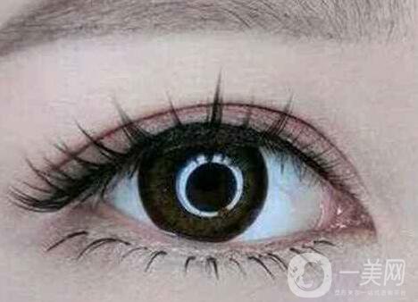 上海開眼角手術(shù)的費用是多少？