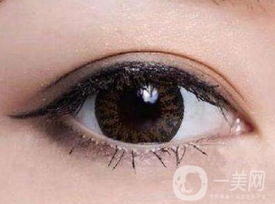 上海開眼角手術(shù)的費用是多少？