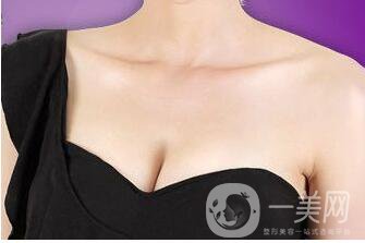 假體豐胸,假體豐胸價格,成都假體豐胸價格