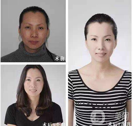 熱瑪吉,熱瑪吉價格,上海熱瑪吉價格