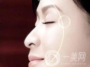 電波拉皮去除抬頭紋*果怎樣？