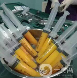 自體脂肪填充隆胸*果怎么樣