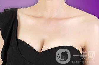 假體豐胸恢復期多久？