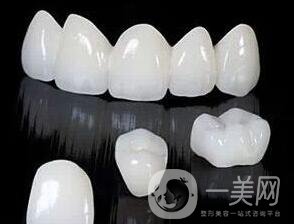 金鈀合金烤瓷牙,金鈀合金烤瓷牙危害