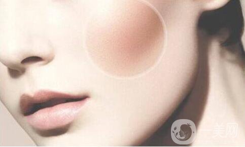 磨顴骨恢復(fù),磨顴骨術(shù)后護(hù)理方式