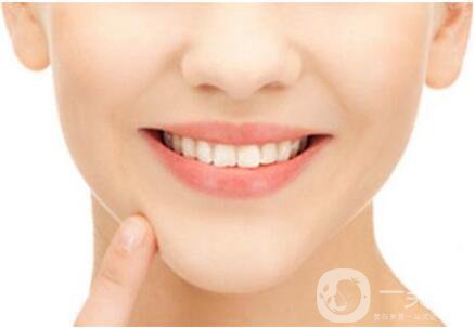 膨體墊下巴,膨體墊下巴價格,武漢膨體墊下巴價格