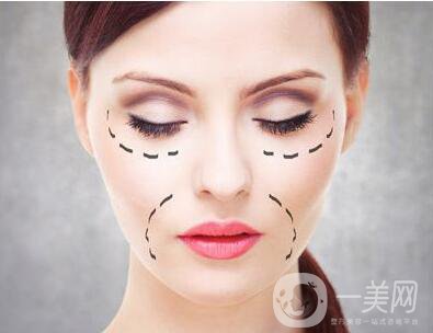 玻尿酸去除法令紋,玻尿酸去除法令紋價格,玻尿酸去除法令紋注意事項