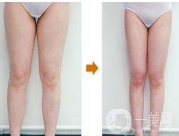 西安*的價(jià)格一般是多少錢