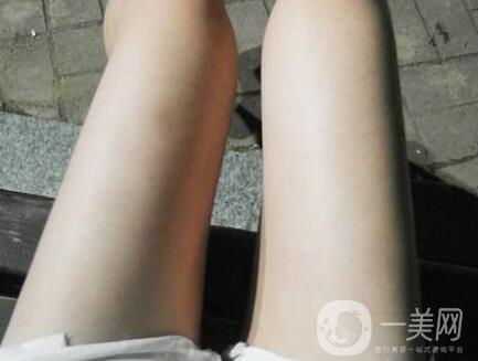 大腿抽脂怎樣快速消腫？術(shù)后護(hù)理方法解說