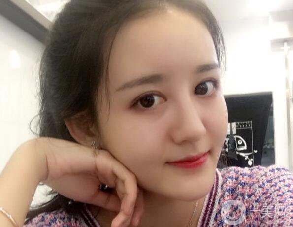 玻尿酸面部填充,玻尿酸面部填充術(shù)后護(hù)理