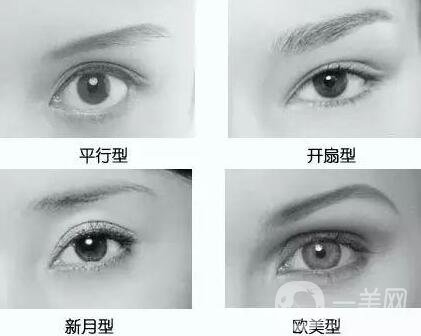 做韓式*雙眼皮術(shù)的優(yōu)點(diǎn)有哪些？