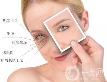 電波拉皮去掉下眼瞼皺紋*果怎么樣