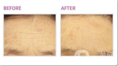 熱瑪吉,熱瑪吉*果,熱瑪吉費用