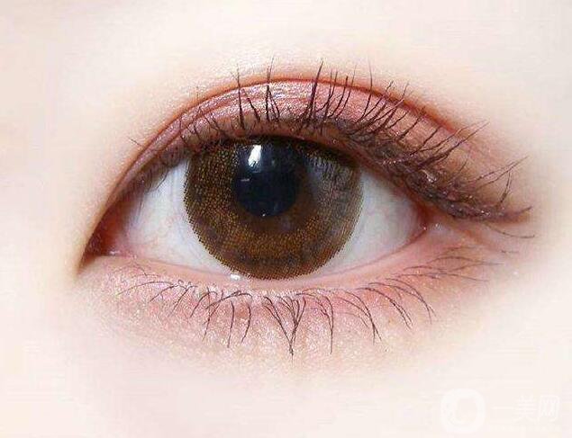 割雙眼皮,割雙眼皮維持多久,割雙眼皮多久恢復