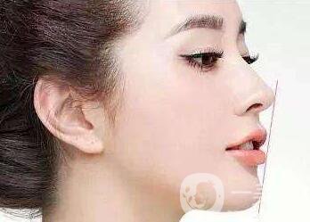 做完*注意事項(xiàng)有哪些？