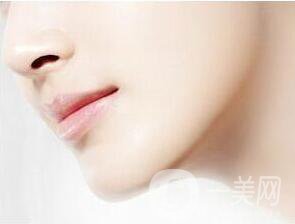 雙下巴吸脂術后護理方法