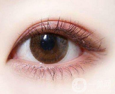 怎樣判斷雙眼皮增生了呢？