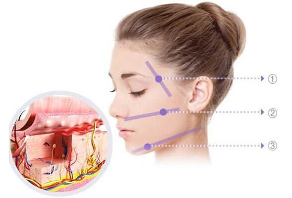 深藍射頻,熱瑪吉,深藍射頻和熱瑪吉區(qū)別