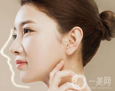 肋骨隆鼻多久可以修復(fù)？