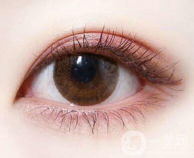 雙眼皮手術(shù)后期護理怎么做？