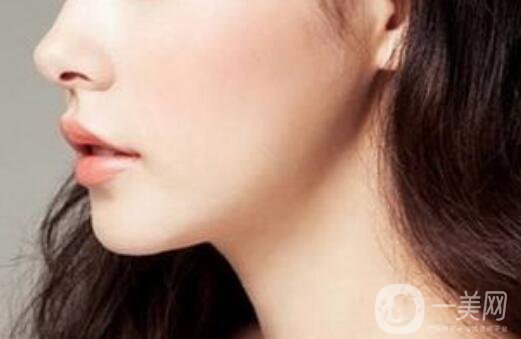 上海自體脂肪隆下巴費(fèi)用,自體脂肪隆下巴注意事項(xiàng)