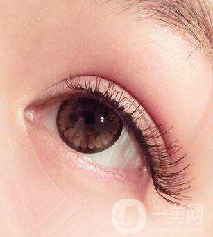 埋線雙眼皮后不能吃啥