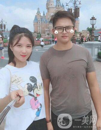 全開(kāi)雙眼皮和開(kāi)眼角