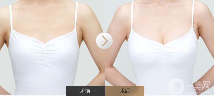 上海曙光醫(yī)院醫(yī)療美容整形價(jià)格表大透露