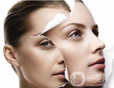 電波拉皮注意事項(xiàng),電波拉皮